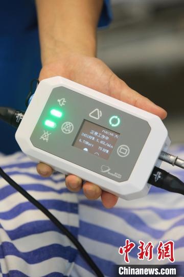 江苏首例“人工心脏”植入患者康复出院