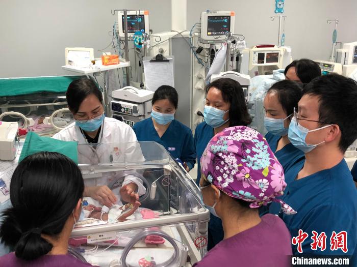 图为医护人员在查看小午的身体状况。 广西妇幼保健院供图 图为医护人员在查看小午的身体状况。 广西妇幼保健院供图