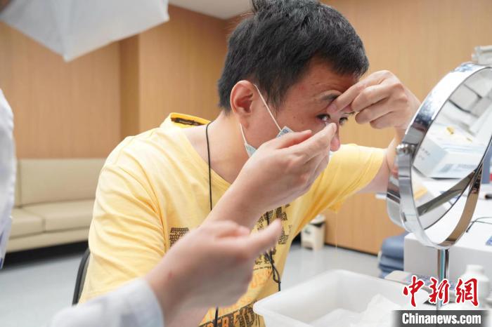 金晓宇佩戴隐形眼镜。 浙大二院供图 金晓宇佩戴隐形眼镜。 浙大二院供图